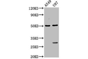 Western Blot Positive WB detected in: A549 whole cell lysate, U87 whole cell lysate All lanes: LANCL2 antibody at 3. (LANCL2 Antikörper  (AA 2-106))