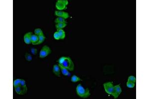 Immunofluorescent analysis of MCF-7 cells using ABIN7148667 at dilution of 1:100 and Alexa Fluor 488-congugated AffiniPure Goat Anti-Rabbit IgG(H+L) (CKMT1A Antikörper  (AA 40-417))