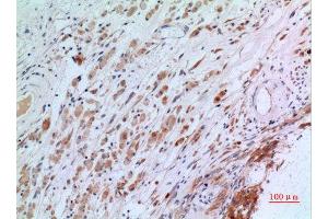 Immunohistochemistry (IHC) analysis of paraffin-embedded Human Brain, antibody was diluted at 1:100. (CGREF1 Antikörper  (N-Term))