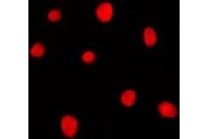Immunofluorescent analysis of MRG15 staining in K562 cells. (MORF4L1 Antikörper)