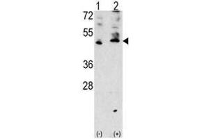 Image no. 1 for anti-Vascular Endothelial Growth Factor C (VEGFC) (AA 255-285), (Middle Region) antibody (ABIN357425) (VEGFC Antikörper  (Middle Region))