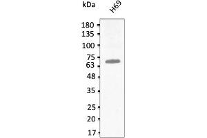 Western Blotting (WB) image for anti-T-Box 18 (TBX18) (C-Term) antibody (ABIN7272987) (T-Box 18 Antikörper  (C-Term))