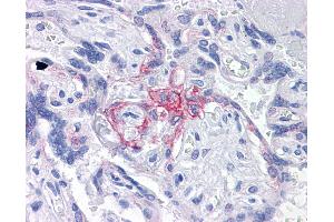 Anti-BUB1B / BubR1 antibody IHC of human placenta. (BUB1B Antikörper  (AA 1-130))