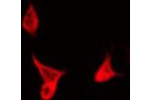 ABIN6266996 staining NIH-3T3 by IF/ICC. (KDELR3 Antikörper  (Internal Region))