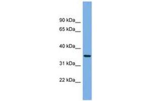 Image no. 1 for anti-Protease, serine, 22 (PRSS22) (AA 35-84) antibody (ABIN6745176) (PRSS22 Antikörper  (AA 35-84))