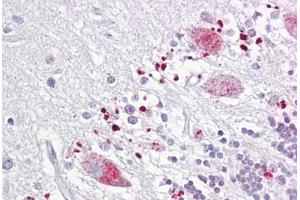 Anti-C12orf5 / TIGAR antibody IHC staining of human brain, cerebellum. (TIGAR Antikörper  (AA 140-190))
