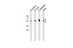 Western Blotting (WB) image for anti-serum/glucocorticoid Regulated Kinase 1 (SGK1) (AA 70-103), (Ser78) antibody (ABIN6243740)