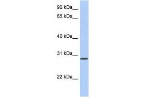 WB Suggested Anti-HAVCR2 Antibody Titration:  0. (TIM3 Antikörper  (N-Term))