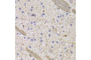 Immunohistochemistry of paraffin-embedded Mouse brain using CNP antibody at dilution of 1:100 (x400 lens).