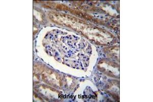 ARL8 Antibody immunohistochemistry analysis in formalin fixed and paraffin embedded human kidney tissue followed by peroxidase conjugation of the secondary antibody and DAB staining. (ARL5B Antikörper  (C-Term))