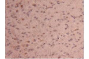 Detection of CPB2 in Mouse Brain Tissue using Polyclonal Antibody to Carboxypeptidase B2 (CPB2) (CPB2 Antikörper  (AA 187-327))