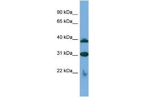 Host:  Rabbit  Target Name:  SLC1A6  Sample Type:  Jurkat Whole cell lysates  Antibody Dilution:  1. (SLC1A6 Antikörper  (C-Term))