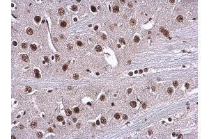 IHC-P Image RPA70 antibody [C1C3] detects RPA1 protein at nucleus in mouse brain by immunohistochemical analysis.