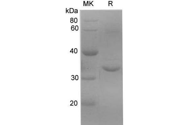 Kallikrein 10 Protein (KLK10) (His tag)