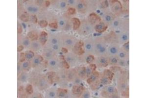 IHC-P analysis of Human Tissue, with DAB staining. (MYCBP Antikörper  (AA 2-103))