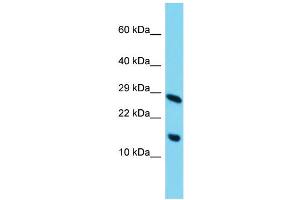 Host: Rabbit Target Name: C11orf52 Sample Type: HepG2 Whole Cell lysates Antibody Dilution: 1. (C11ORF52 Antikörper  (C-Term))