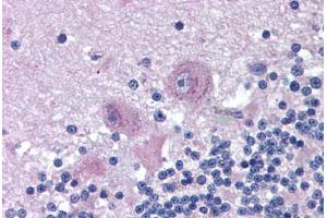 Human Brain, Cerebellum (formalin-fixed, paraffin-embedded) stained with SNX26 antibody ABIN290200 at 2. (SNX26 Antikörper  (AA 1113-1126))