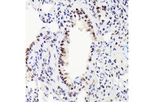 Immunohistochemistry of paraffin-embedded rat lung using EWSR1 Rabbit mAb (ABIN7267053) at dilution of 1:100 (40x lens). (EWSR1 Antikörper)