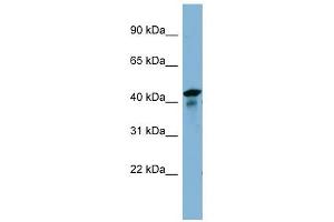 UEVLD antibody used at 1 ug/ml to detect target protein. (UEVLD Antikörper  (N-Term))