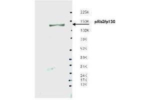 Western blot using  affinity purified anti-Spa310 antibody shows detection of endogenous pRb2/p130 protein in whole LNCaP cell extracts. (p130 Antikörper)