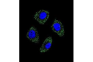 Confocal immunofluorescent analysis of EDN1 Antibody (Center)  with A549 cell followed by Alexa Fluor 488-conjugated goat anti-rabbit lgG (green). (Endothelin 1 Antikörper  (Center))