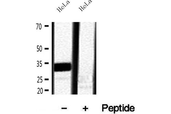 Ribonuclease H1 Antikörper  (Internal Region)