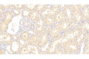 Detection of SPHK1 in Human Kidney Tissue using Polyclonal Antibody to Sphingosine Kinase 1 (SPHK1)