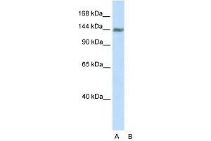 WB Suggested Anti-TIMELESS Antibody Titration:  2. (TIMELESS Antikörper  (C-Term))