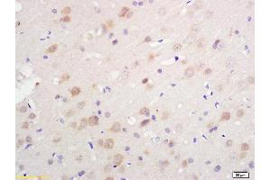 Formalin-fixed and paraffin embedded rat brain tissue labeled with Anti S-100/S100A1 Polyclonal Antibody, Unconjugated (ABIN728983) at 1:200 followed by conjugation to the secondary antibody and DAB staining. (S100A1 Antikörper)