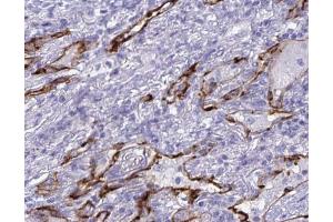 ABIN6268712 at 1/100 staining human lung tissues sections by IHC-P. (Aquaporin 4 Antikörper  (Internal Region))
