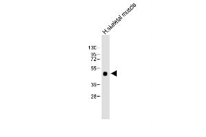 Anti-WIF1 Antibody (Human C-term) at 1:2000 dilution + Human skeletal muscle lysate Lysates/proteins at 20 μg per lane.