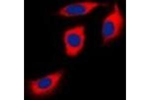 Immunofluorescence (IF) image for anti-Ephrin Type A Receptor 1 (EPHA1) antibody (ABIN7303062)