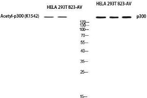 Western Blot (WB) analysis of HeLa 293T 823-AV using EP300 antibody. (p300 Antikörper)