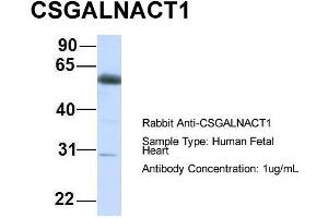 Host:  Rabbit  Target Name:  CSGALNACT1  Sample Type:  Human Fetal Heart  Antibody Dilution:  1. (CSGALNACT1 Antikörper  (C-Term))