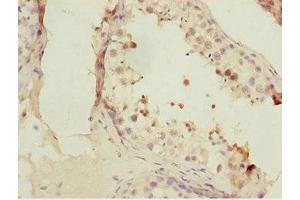 Immunohistochemistry of paraffin-embedded human testis tissue using ABIN7153074 at dilution of 1:100 (FOXN2 Antikörper  (AA 172-431))