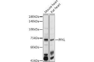 Western blot analysis of extracts of various cell lines, using PFKL antibody (ABIN7269308) at 1:1000 dilution. (PFKL Antikörper  (AA 700-780))