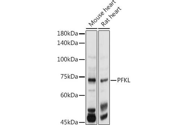 PFKL 抗体  (AA 700-780)