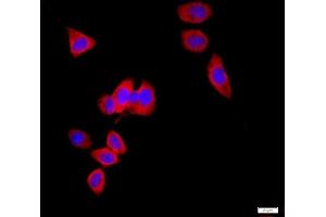 HeLa cells were stained with AQP1 Polyclonal Antibody, Unconjugated at 1:500 in PBS and incubated for two hours at 37°C followed by Goat Anti-Rabbit IgG (H+L) Cy3 conjugated secondary antibody.