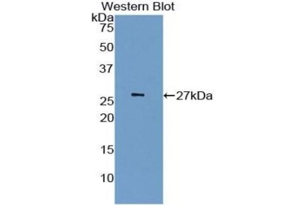 Latexin Antikörper  (AA 1-223)