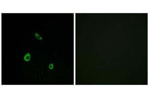 Immunofluorescence analysis of LOVO cells, using MAPK15 antibody. (MAPK15 Antikörper  (Internal Region))
