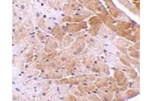 Immunohistochemistry of CIDE-A in mouse heart tissue with CIDE-A antibody at 5 μg/ml. (CIDEA Antikörper  (C-Term))