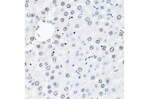 Immunohistochemistry of paraffin-embedded rat liver using HIST2H2BE antibody.