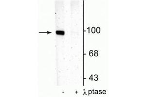 Western blot of rat hippocampal lysate showing specific immunolabeling of the ~100 kDa GluR1 protein phosphorylated at Ser831 in the first lane (-). (Glutamate Receptor 1 Antikörper  (pSer831))