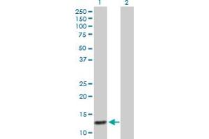 Western Blotting (WB) image for anti-ATP-Binding Cassette, Sub-Family C (CFTR/MRP), Member 6 (ABCC6) (AA 1-99) antibody (ABIN513449)