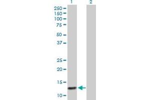 Western Blot analysis of ABCC6 expression in transfected 293T cell line by ABCC6 MaxPab polyclonal antibody. (ABCC6 Antikörper  (AA 1-99))