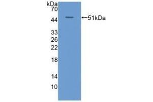 Detection of Recombinant KRT20, Human using Polyclonal Antibody to Cytokeratin 20 (CK 20) (KRT20 Antikörper  (AA 9-424))