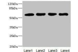 Western blot All lanes: IL21R antibody at 2. (IL21 Receptor Antikörper  (AA 20-240))
