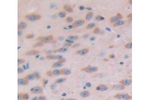 Immunohistochemistry (IHC) image for anti-Sema Domain, Immunoglobulin Domain (Ig), Short Basic Domain, Secreted, (Semaphorin) 3A (SEMA3A) (AA 31-150) antibody (ABIN1860519)