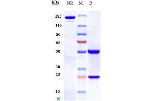 Anti-B7-H4 / VTCN1 Reference Antibody (alsevalimab) on SDS-PAGE under reducing (R) condition. (Rekombinanter B7-H4 (Alsevalimab Biosimilar) Antikörper)