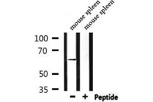 Western blot analysis of extracts from mouse spleen, using CaMKIIbeta/gamma Antibody. (CaMK2 beta/gamma Antikörper)